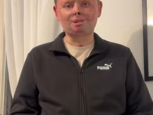 Maciej Krzysik wrócił do domu po tragicznym wypadku w Rajdzie Nyskim. Przed nim długa droga do powrotu do normalności