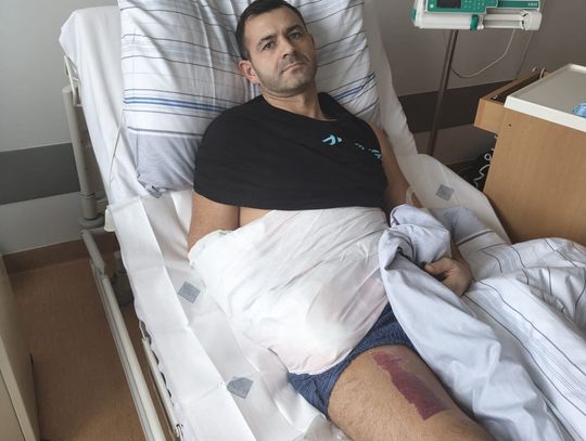 Strażacy ruszają z pomocą koledze. „Ratujmy rękę Jacka” – zbiórka dla bohatera z Nysy