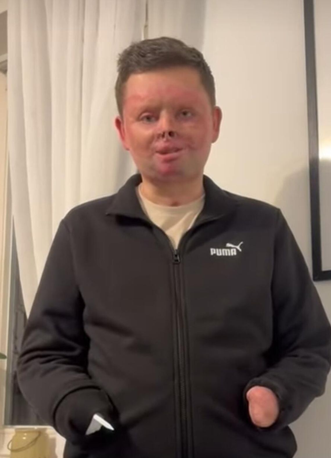 Maciej Krzysik wrócił do domu po tragicznym wypadku w Rajdzie Nyskim. Przed nim długa droga do powrotu do normalności Maciej Krzysik wrócił do domu po tragicznym wypadku w Rajdzie Nyskim. Przed nim długa droga do powrotu do normalności