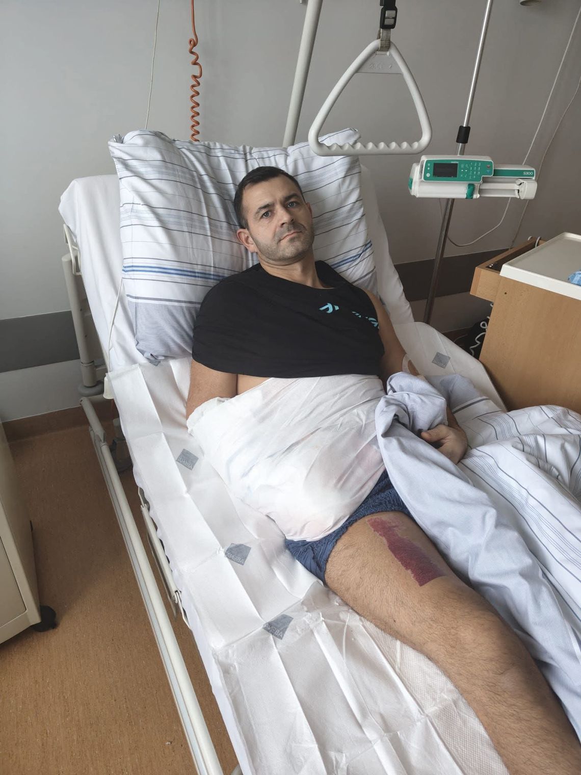 Strażacy ruszają z pomocą koledze. „Ratujmy rękę Jacka” – zbiórka dla bohatera z Nysy